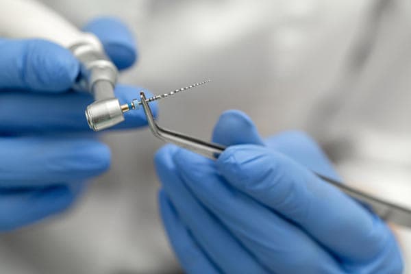 Endodoncias en Ferrol