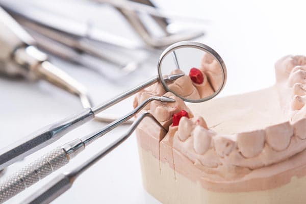 Periodoncias en Ferrol