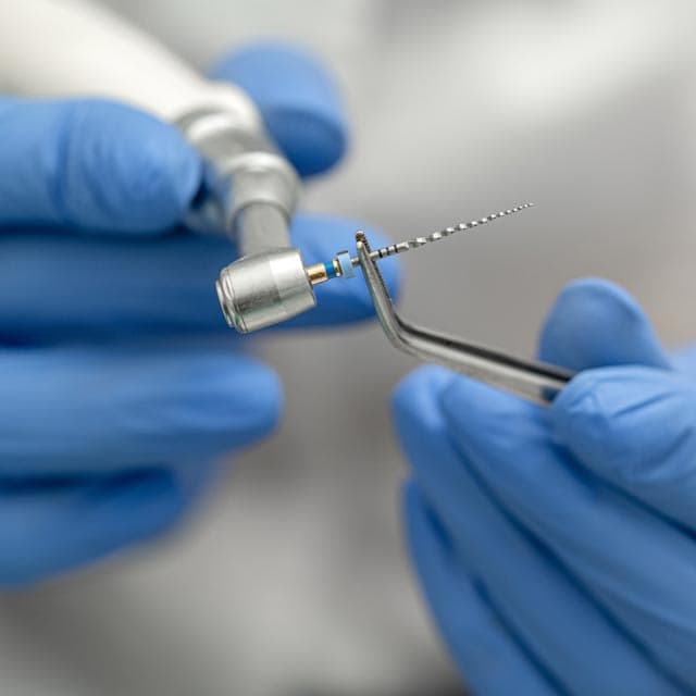 Endodoncias en Ferrol para salvar dientes dañados - Dental San Juan