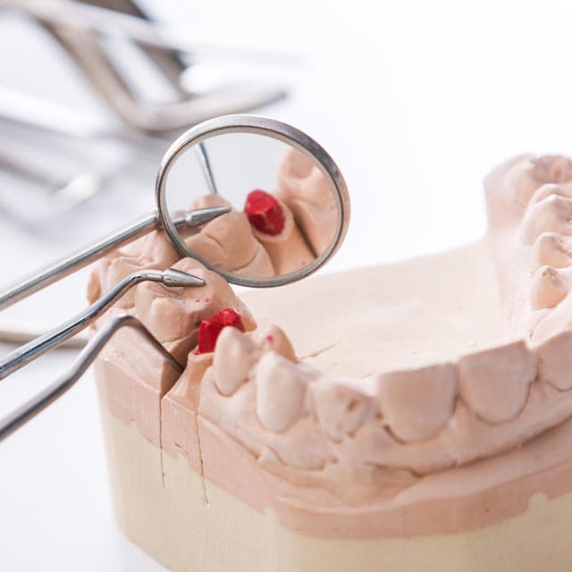 Tratamientos de periodoncia en Ferrol - Dental San Juan